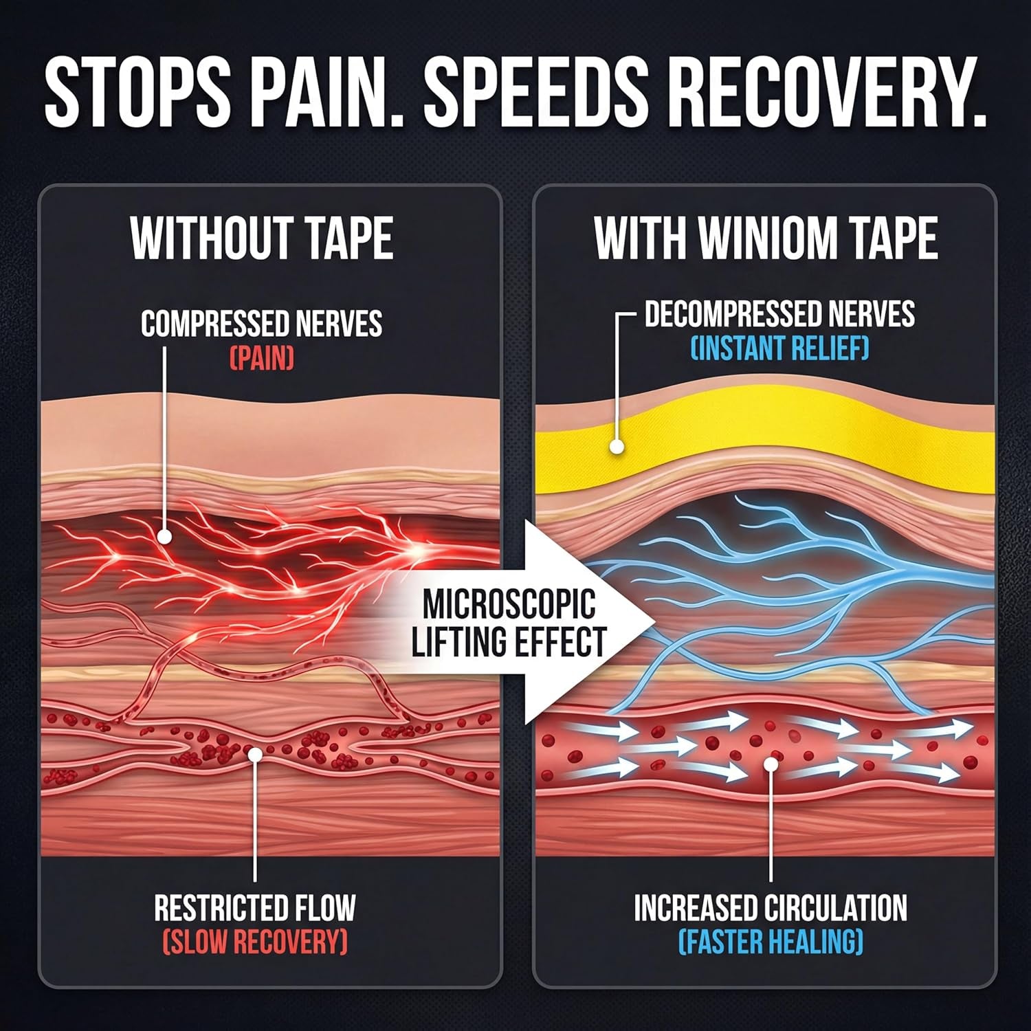 Kinesiology Tape-Incredible Support for Athletic Sports and Recovery+Free Taping Guide - Uncut 2 Inch 16.4 Feet Roll (Sunny Yellow + Free Taping Guide, Pack of 1)