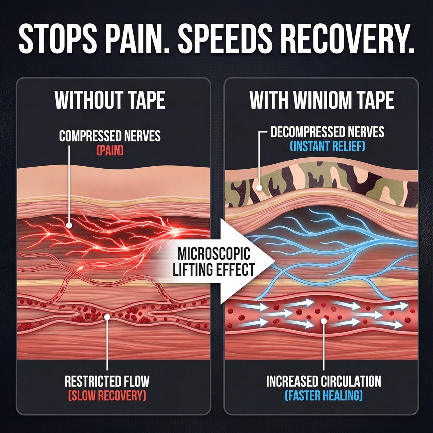 Kinesiology Tape-Incredible Support for Athletic Sports and Recovery+Free Taping Guide - Uncut 2 Inch 16.4 Feet Roll (Forest Camo + Free Taping Guide, Pack of 1)