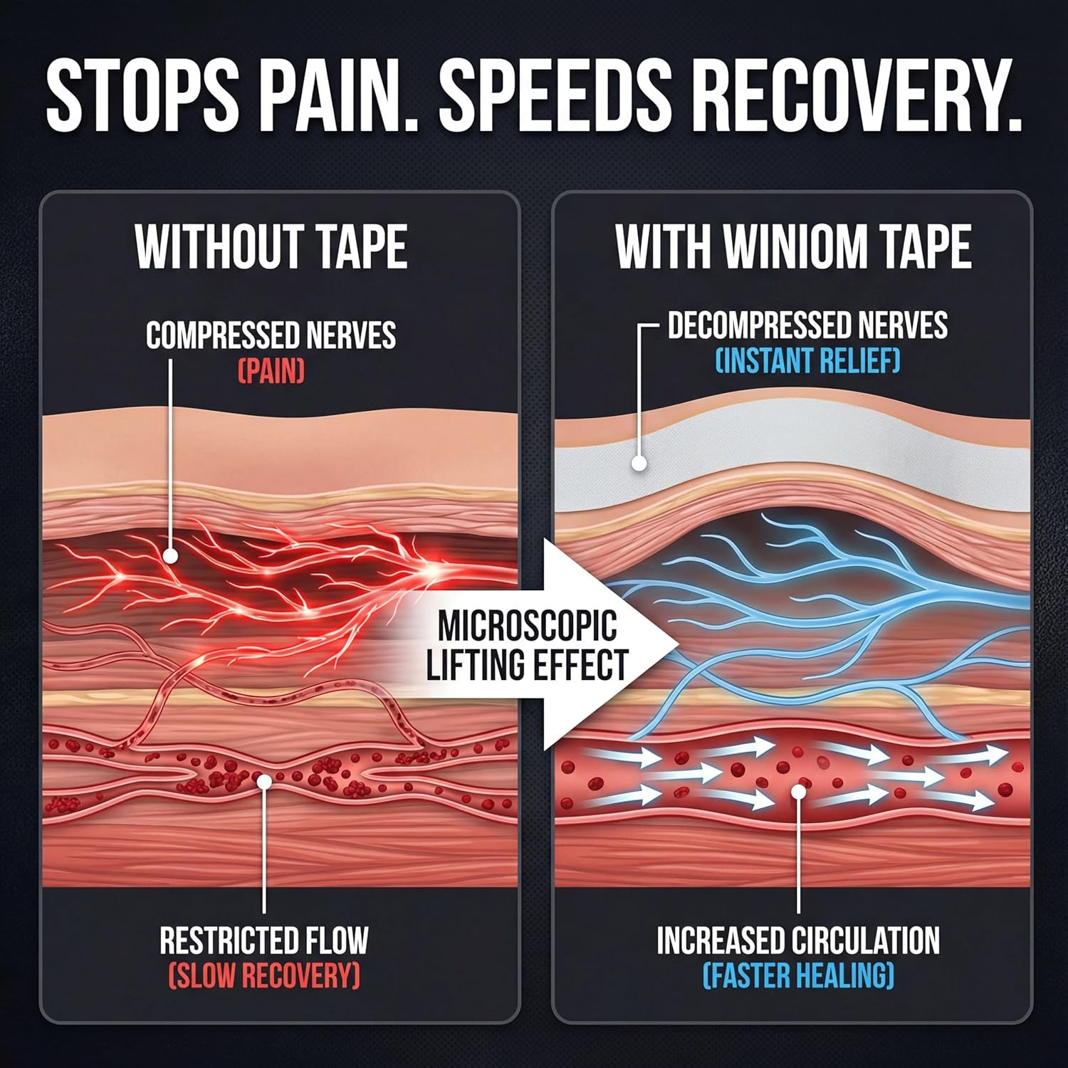 Kinesiology Tape-Incredible Support for Athletic Sports and Recovery+Free Taping Guide - Uncut 2 Inch 16.4 Feet Roll (Frosted White + Free Taping Guide, Pack of 1)