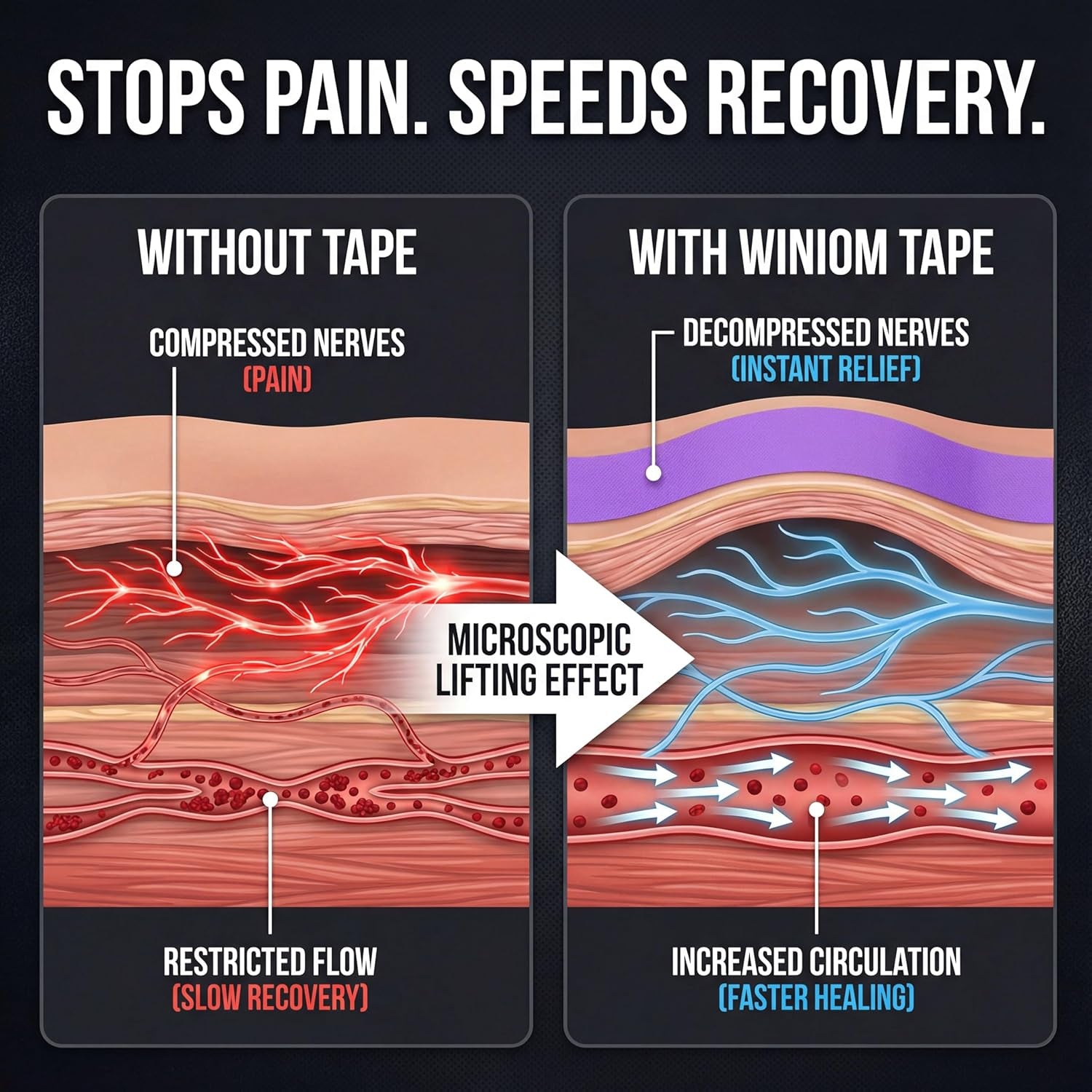 Kinesiology Tape-Incredible Support for Athletic Sports and Recovery+Free Taping Guide - Uncut 2 Inch 16.4 Feet Roll (Indigo Purple + Free Taping Guide, Pack of 1)